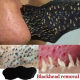 Hot sale BLACKHEAD removing acne nose MASK nasal patch BLACKHEAD MASK 5PCS 10PCS 15PCS 20PC