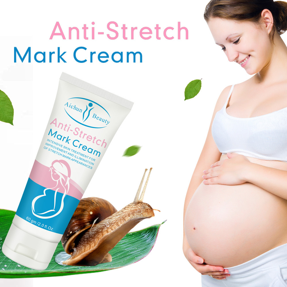 Cross-border Aichun Body Milk Refreshing, Not Greasy, Moisturizing and Growing Grain-removing Wholesale Stretch mark cream