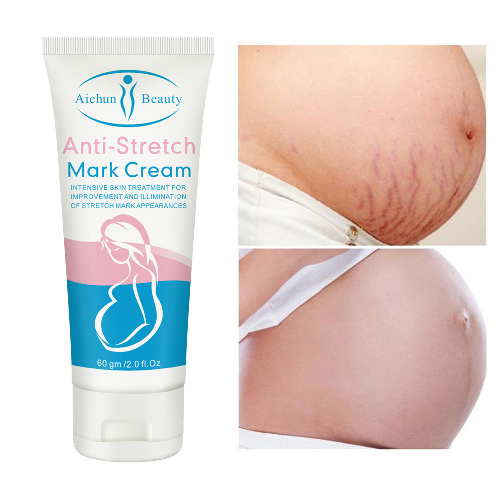 Cross-border Aichun Body Milk Refreshing, Not Greasy, Moisturizing and Growing Grain-removing Wholesale Stretch mark cream