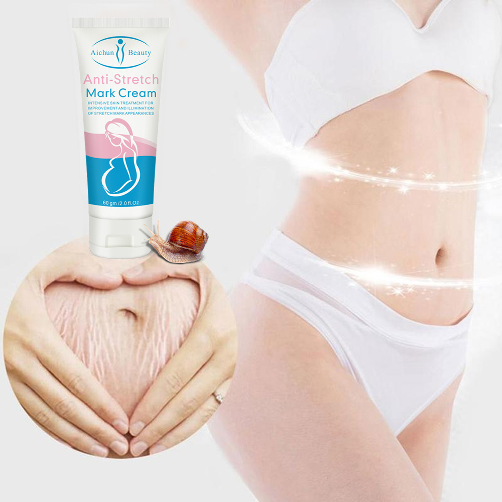 Cross-border Aichun Body Milk Refreshing, Not Greasy, Moisturizing and Growing Grain-removing Wholesale Stretch mark cream