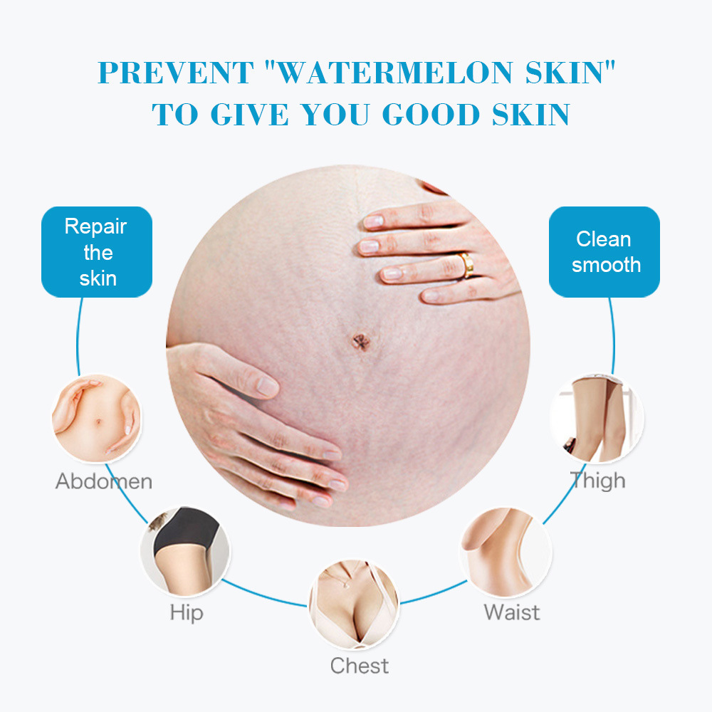 Cross-border Aichun Body Milk Refreshing, Not Greasy, Moisturizing and Growing Grain-removing Wholesale Stretch mark cream
