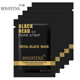ROSOTENA blackhead acne removal grease nasal membrane removal blackhead pig nose patch BLACK MASk