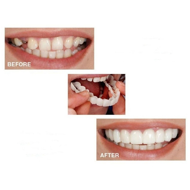 One-piece delivery in stock snap on smile silicone simulation braces whitening braces factory direct sales