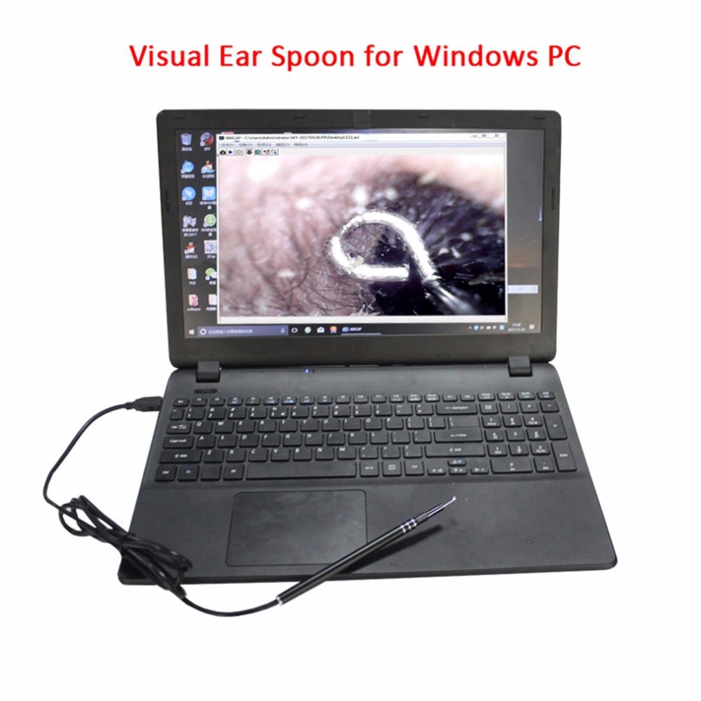 Visual ear spoon ear canal endoscope HD ear pick ear nose cleaning children's dental safety computer endoscope
