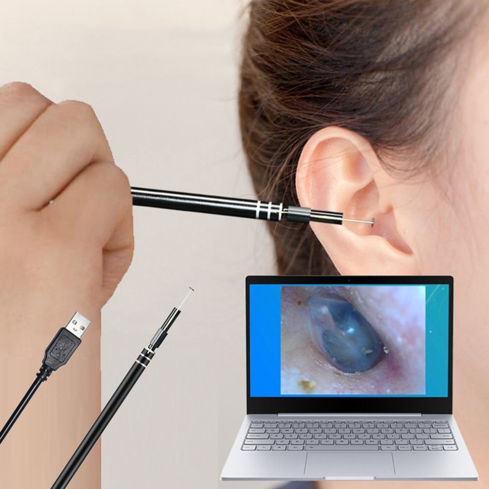 Visual ear spoon ear canal endoscope HD ear pick ear nose cleaning children's dental safety computer endoscope