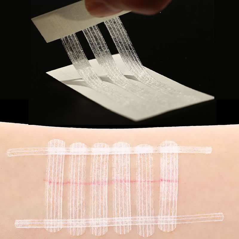 シームレスな医療テープ一緒に引っ張る通気性創傷閉鎖外科粘着テープ創傷治癒術後ドレッシング|undefined