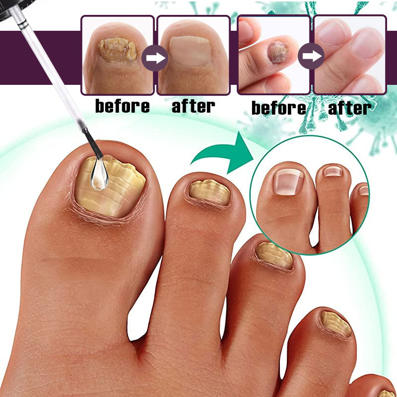 carousel-thumb-2