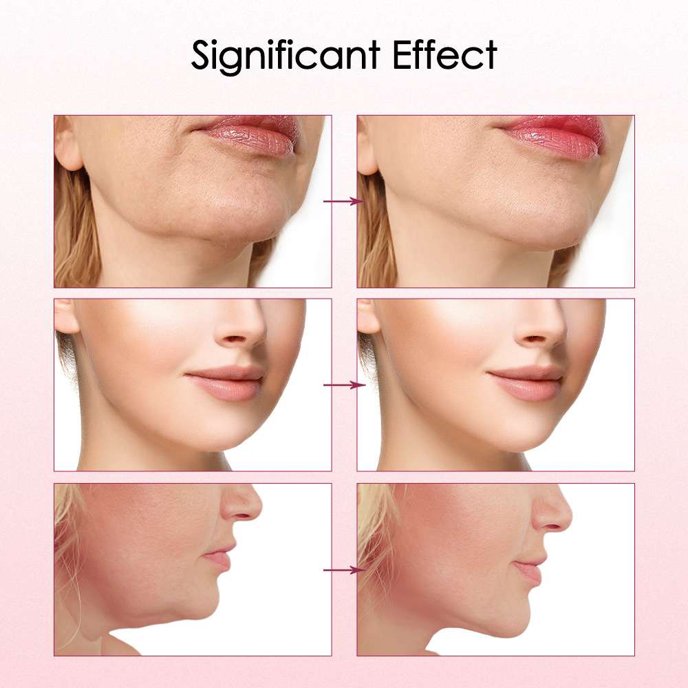Cross-border micro-current face slimming instrument v15 gear heating type face lifting and tightening double chin micro-current face slimming instrument