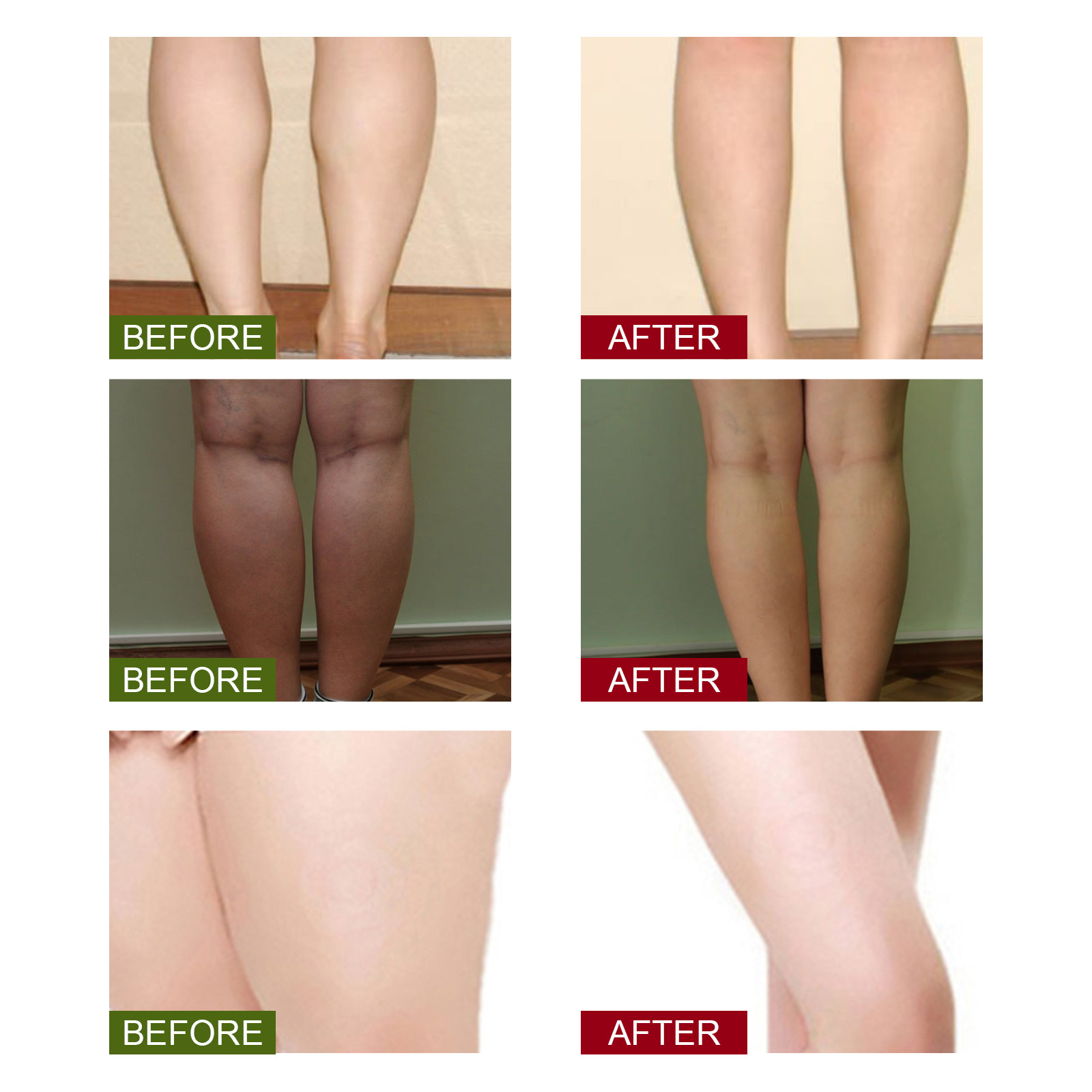 South Moon Wormwood body cleansing foot patch to relieve body slimming and body shaping to relieve body pressure foot care patch