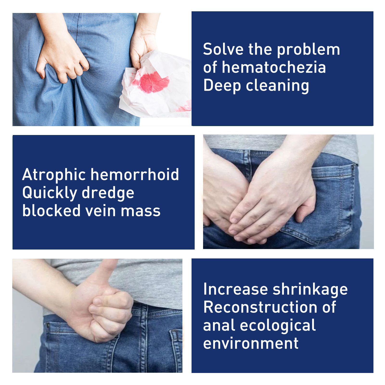 South Moon Hemorrhoids Ointment anal repair and meat ball inside and outside mixed Qi anal relieving swelling itching pain cream