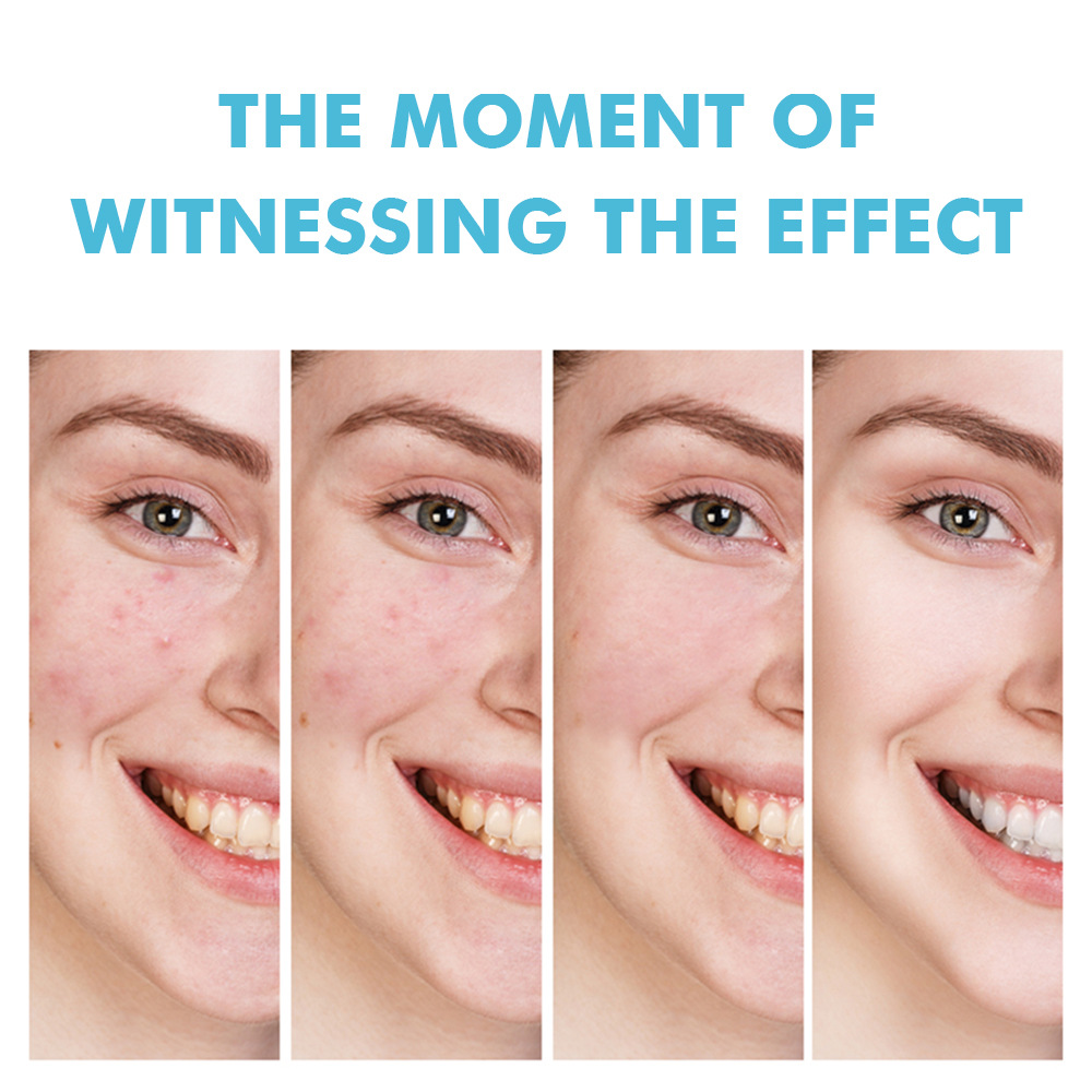 Cross-border salicylic acid acne cream to fade acne marks to eliminate acne and shrink pores plant essence acne gel