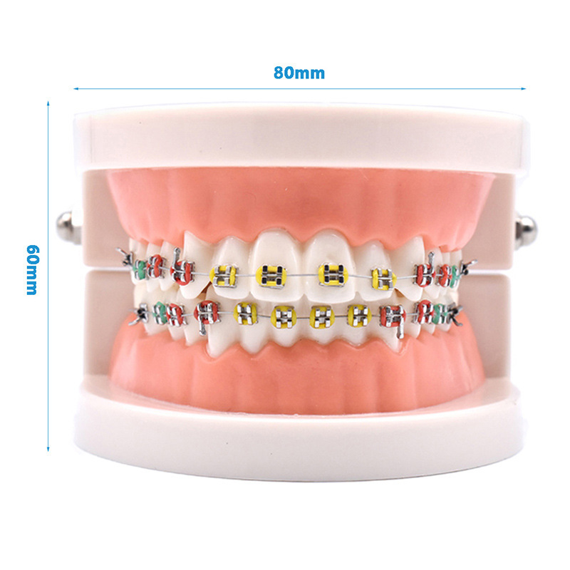 歯科矯正材料金属ブラケットモデルディスプレイ口腔歯科ケアブラケットモデル歯矯正用|undefined
