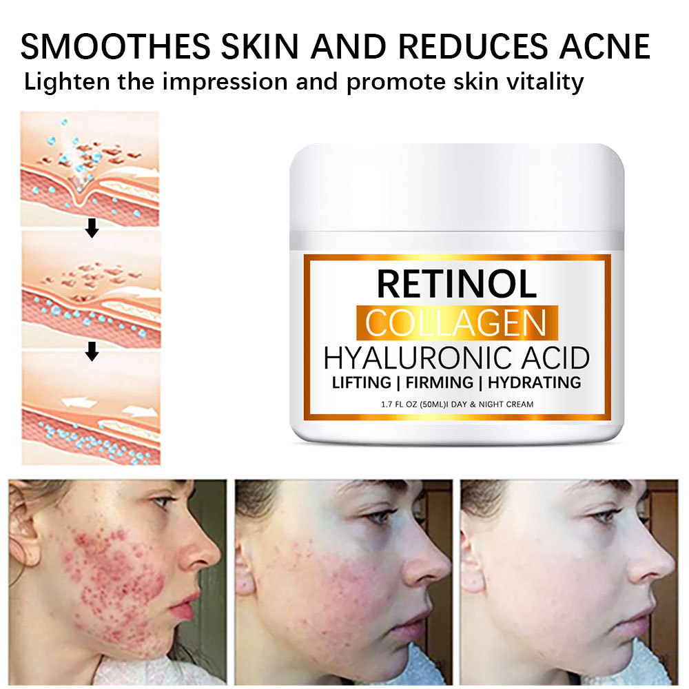 Cross-border retinol collagen double-effect cream moisturizing fade melanin brightening white anti-wrinkle