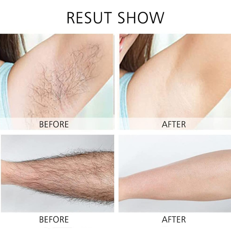 Manufacturer in stock four-head shaver women's electric USB hair removal instrument thigh body no pain marks small Shaver