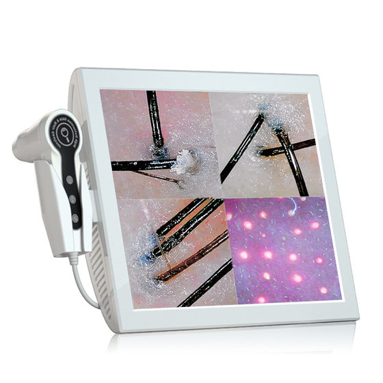 15-inch four-compartment scalp detector HD all-in-one machine intelligent hair follicle hair analyzer skin detector