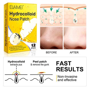 ELAIMEI hydrocolloid blackhead acne removing nose paste pore cleansing white head nose mask mild and does not hurt skin 12pcs