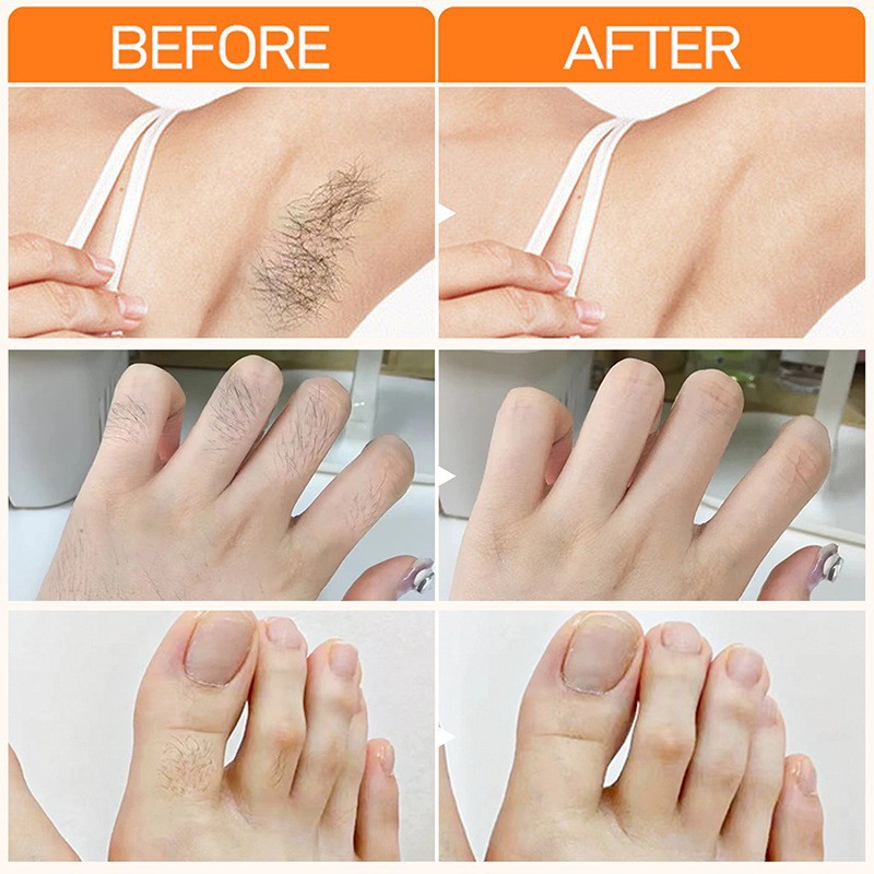 JoyPretty lip hair removal cream men's and women's lip hair removal facial gentle beard armpit private hair removal cream