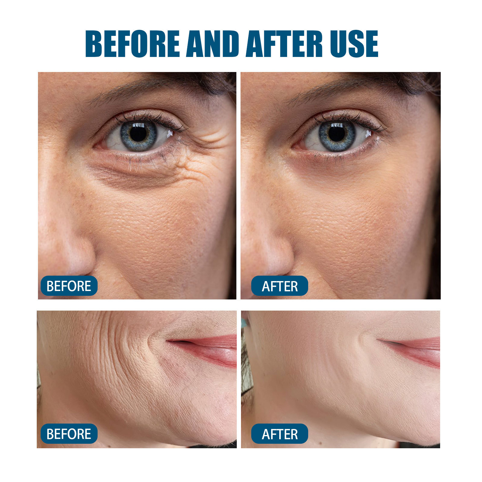 Eelhoe V89 Probiotic Serum Essence Gentlely Nourishes Facial Skin Hydrating Moisturizing Skin Care Essence