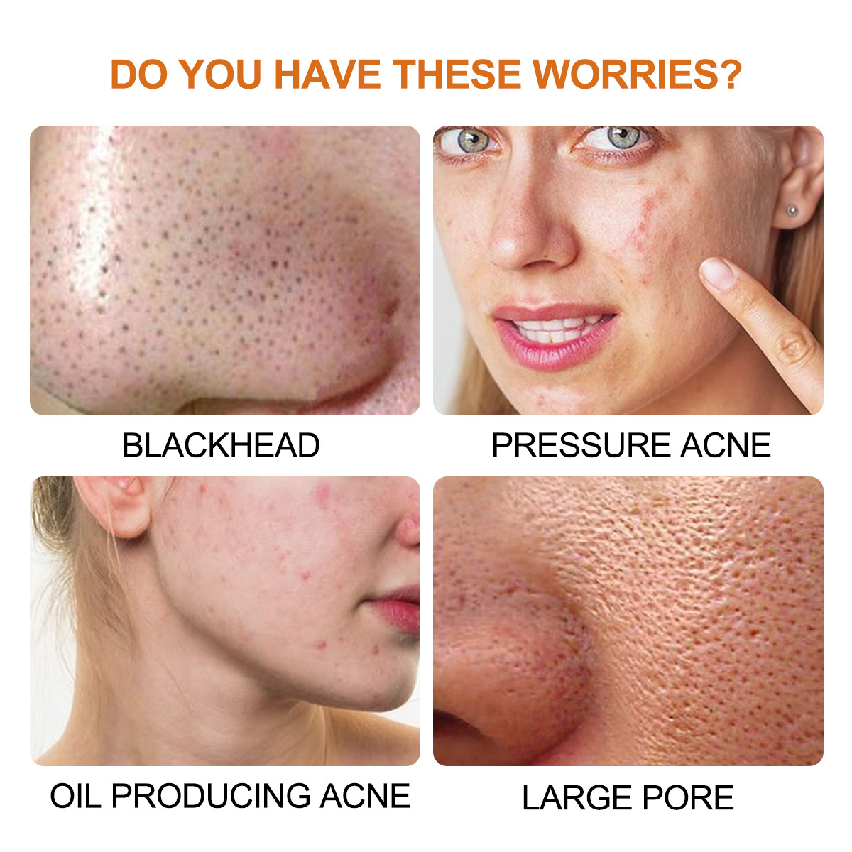 Cross-border hydrogel blackhead removing NOSE patch NOSE STRIPS pore cleansing NOSE mask tearing patch