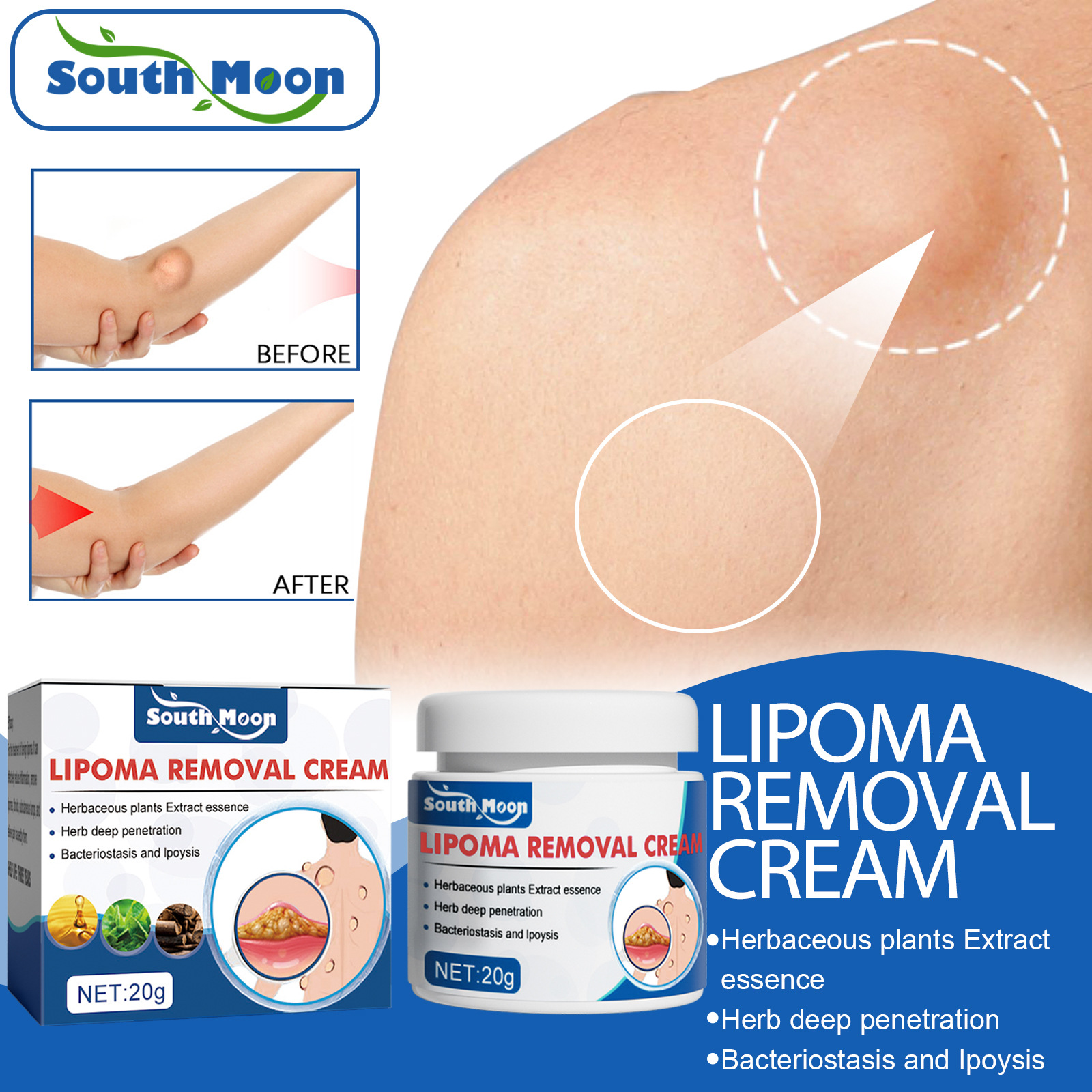 South Moon Fat Paste Repair and Dredge Fat Cough Cough Nodules Subcutaneous Masses Body Care Paste