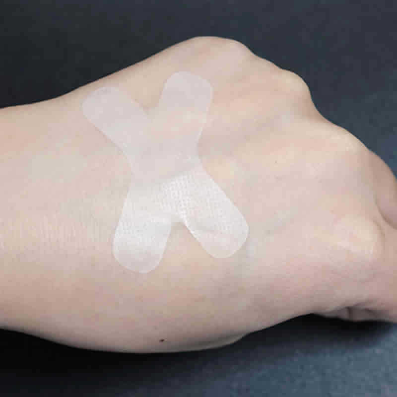 Medical X-type closed mouth patch for adults and children to prevent mouth opening at night snoring sealing mouth breathable pe elastic cloth breathing patch