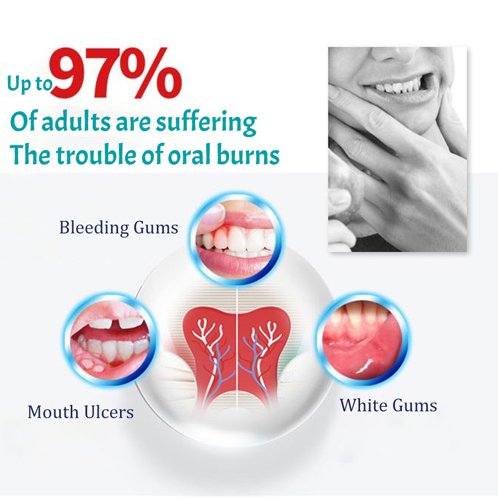 Cross-border PeiMei toothpaste fire-clearing teeth cleaning Breath Freshening Teeth fixing VITAMIN B12 toothpaste