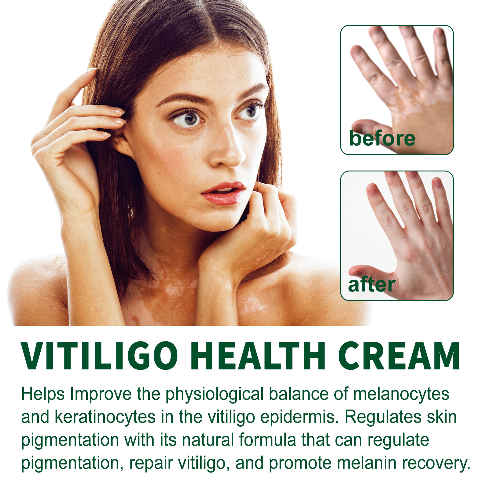 South Moon white spot care cream white spot sweat spot flower spot body skin care external skin care cream