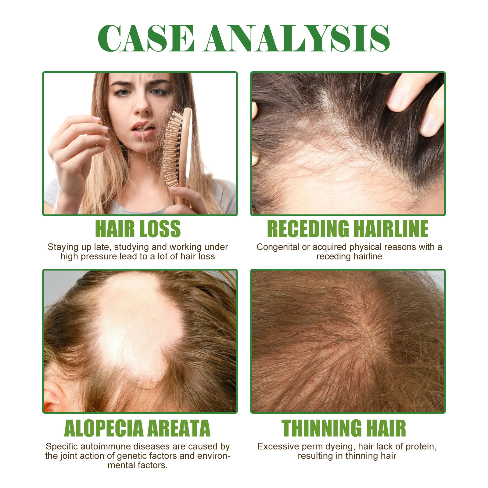 EELHOE Rosemary hair care essential oil hair repair damaged anti-hair fixing dense hair soft hair care essential oil