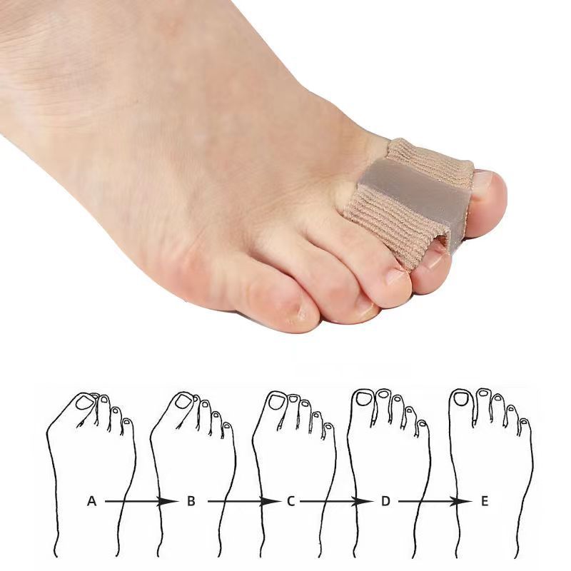 Cross-Border Toe Separator Thumb Valgus Big Foot Bone Overlapping Toe Separator Men's and Women's Fiber Double Hole Sleeve Orthosis