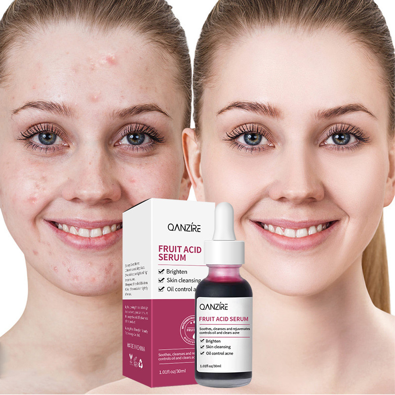 Cross-border foreign trade fruit acid essence liquid acne fruit acid essence almond acid essence in stock