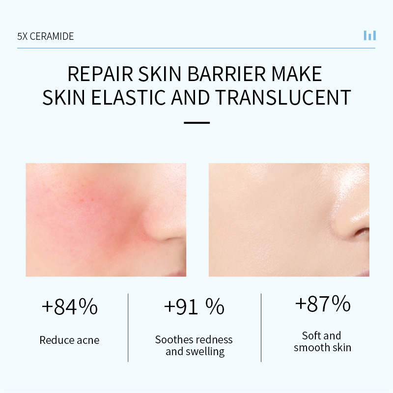 Cross-border foreign trade ceramide moisturizing cream Moisturizing face cream moisturizing cream genuine goods