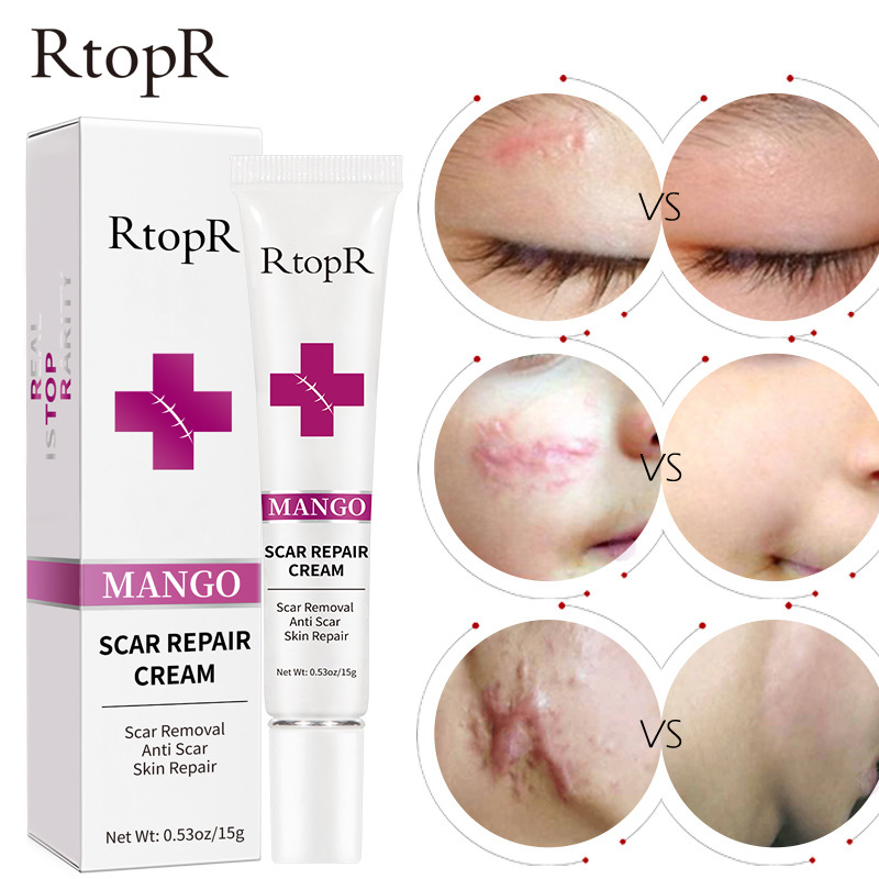 RtopR Repair Remove Scar Cream qu hen 膏 速卖通彩妆 RtopR028