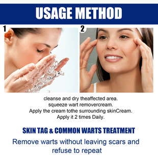 EELHOE Skin Label Removal Cream Corn Warts Flat Removal Skin Care Cleansing Skin Keyou Cream