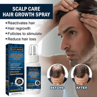 East moon Men's Hair Care Spray Hairline Hair Care Moisturizing Hair Care Hair Care Spray