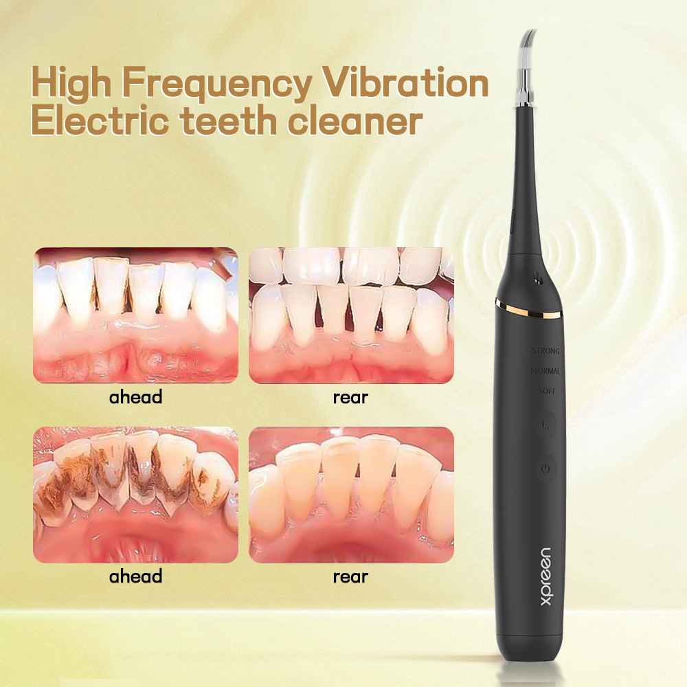 Hot selling household electric dental scaler to remove tartar calculus oral care whitening instrument dental scaler set