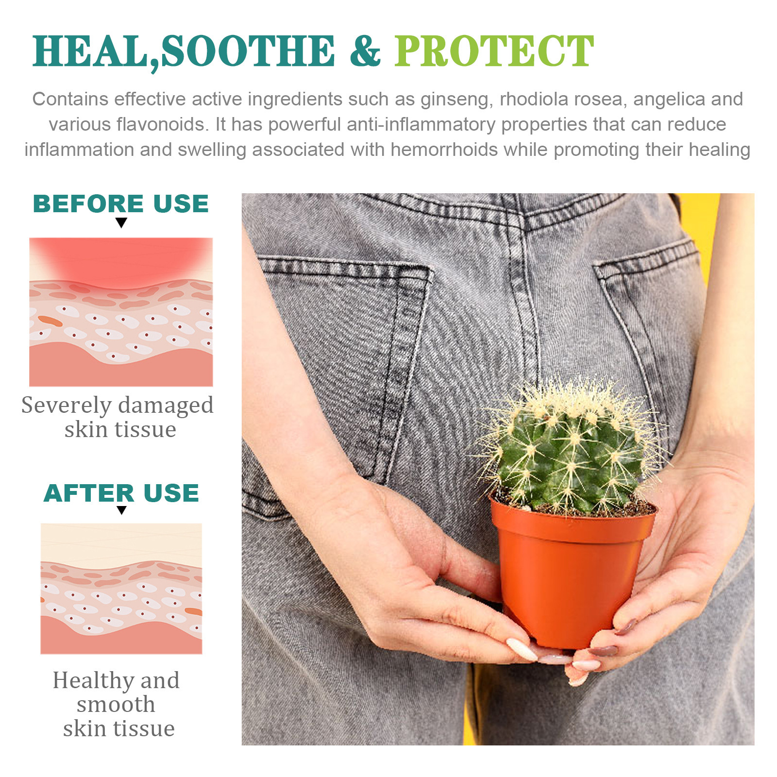South Moon hemorrhoids capsule relieve perianal itching internal and external mixed sore anal shu cream eliminate meat ball broken hemorrhoids cream