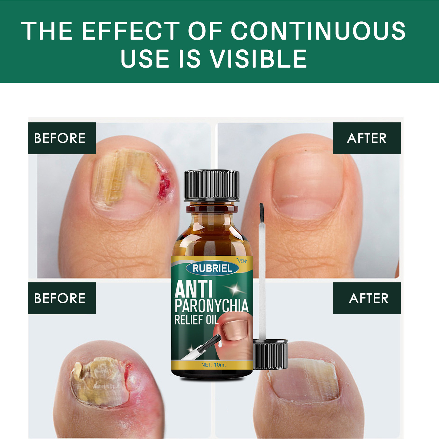 Cross-border nail repair solution nail care hands and feet Nail Repair Moisturizing cleaning nail removal solution wholesale