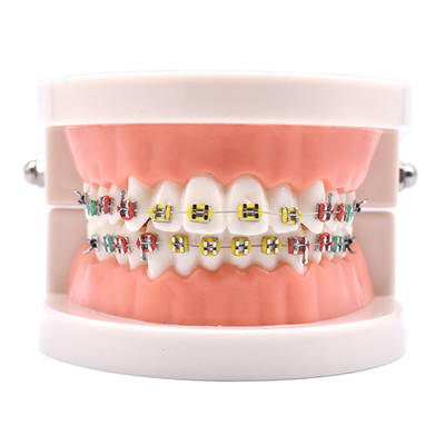 dental material orthodontic model metal bracket model display model oral dental bracket model