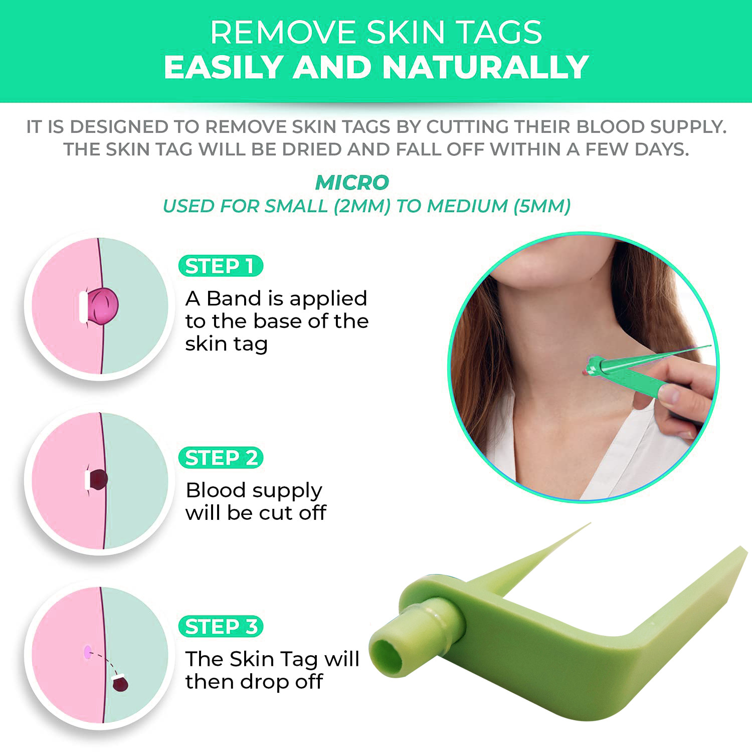 Skin Tag rubber Band Removal Tool kit remove meat mole corns remove wart Skin burden Green