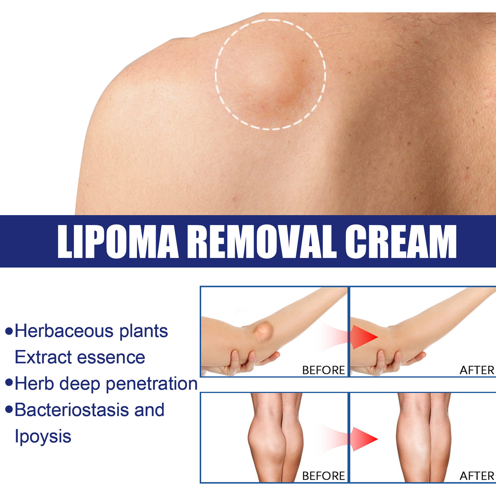 South Moon Fat Paste Repair and Dredge Fat Cough Cough Nodules Subcutaneous Masses Body Care Paste