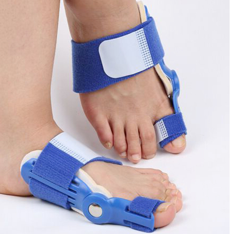 Thumb valgus separator separate overlapping toe thumb valgus corrector