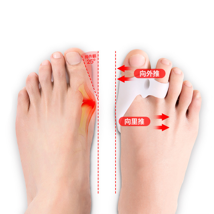 Hallux valgus corrector toe separator silicone toe splitter big foot bone anti-wear sleeve thumb valgus correction pad