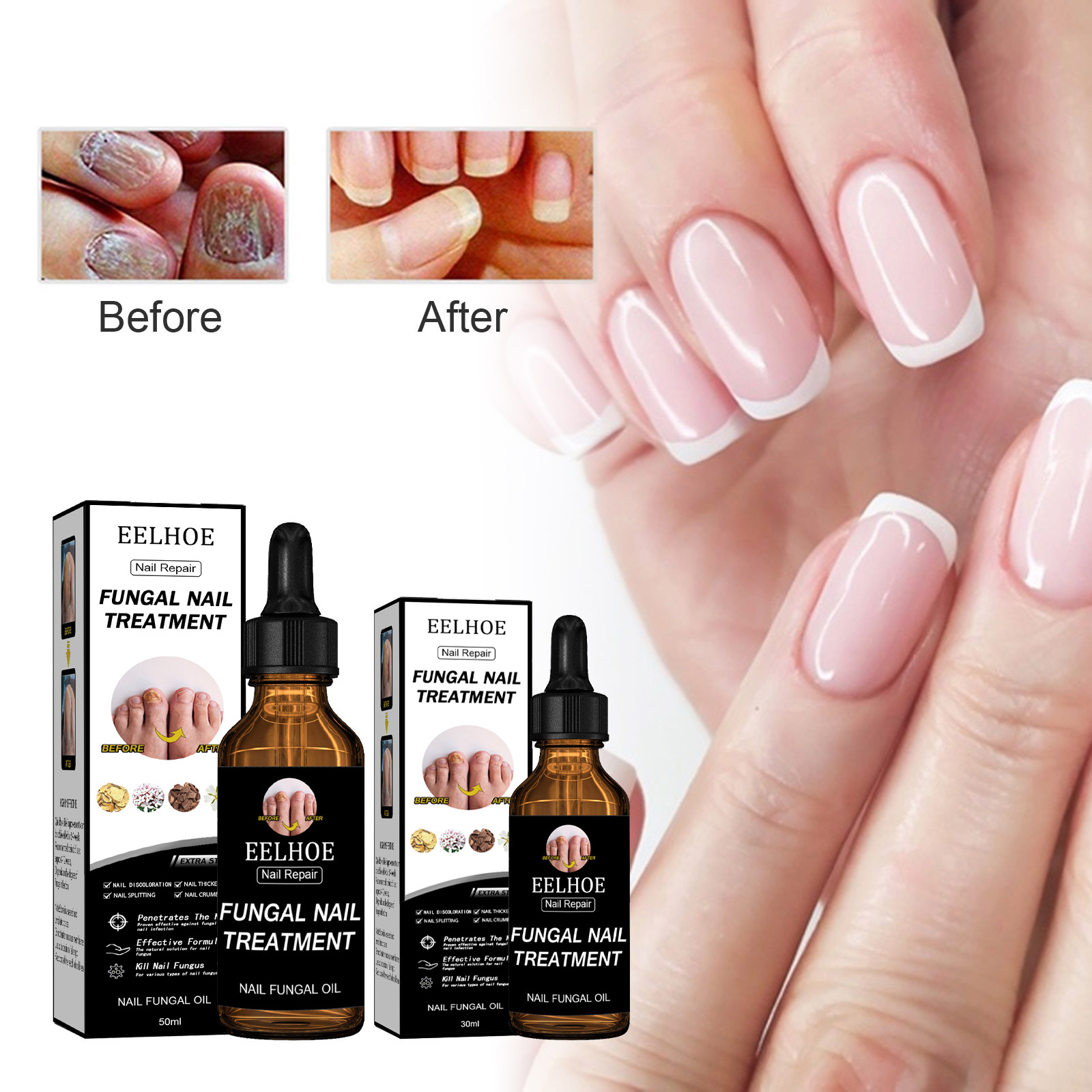 EELHOE Thickening Nail Repair Solution, Shiny Nail Dead Skin Removal Repair Moisturizing Nail Care Liquid
