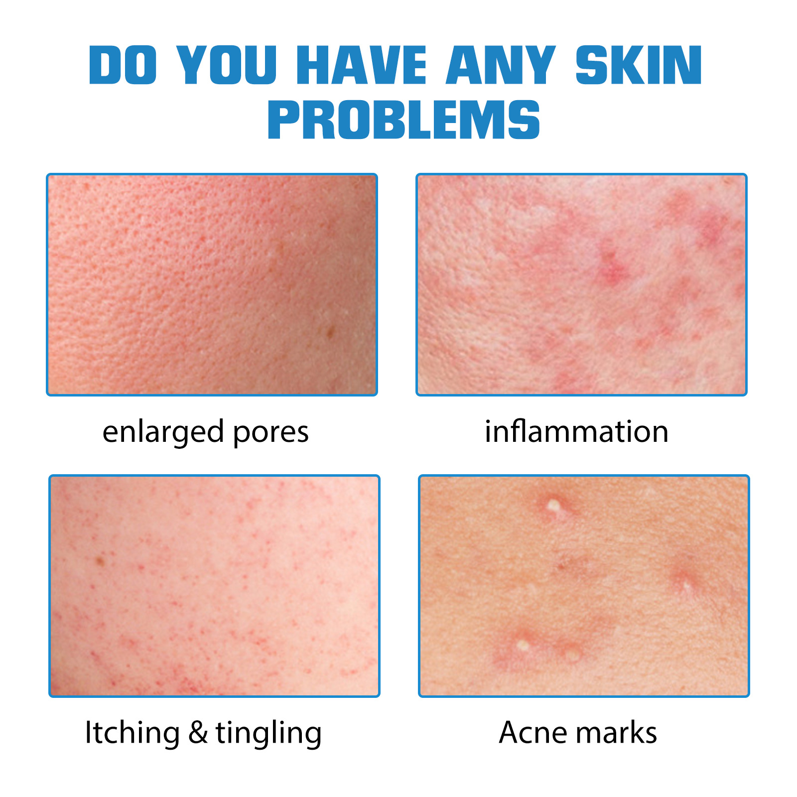 EELHOE Hyaluronic Acid Essence Hydrating Moisturizing Repair Fading Face Pockmarks Skin Care Whitening Essence
