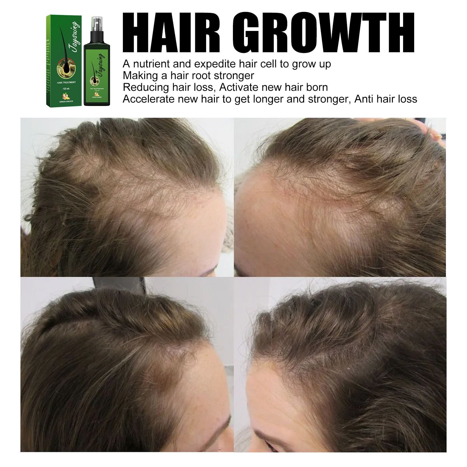 Jaysuing Hair Condiment Strong Hair Nourishing Hair Root Repair Hair Scalp Massage Nutrient