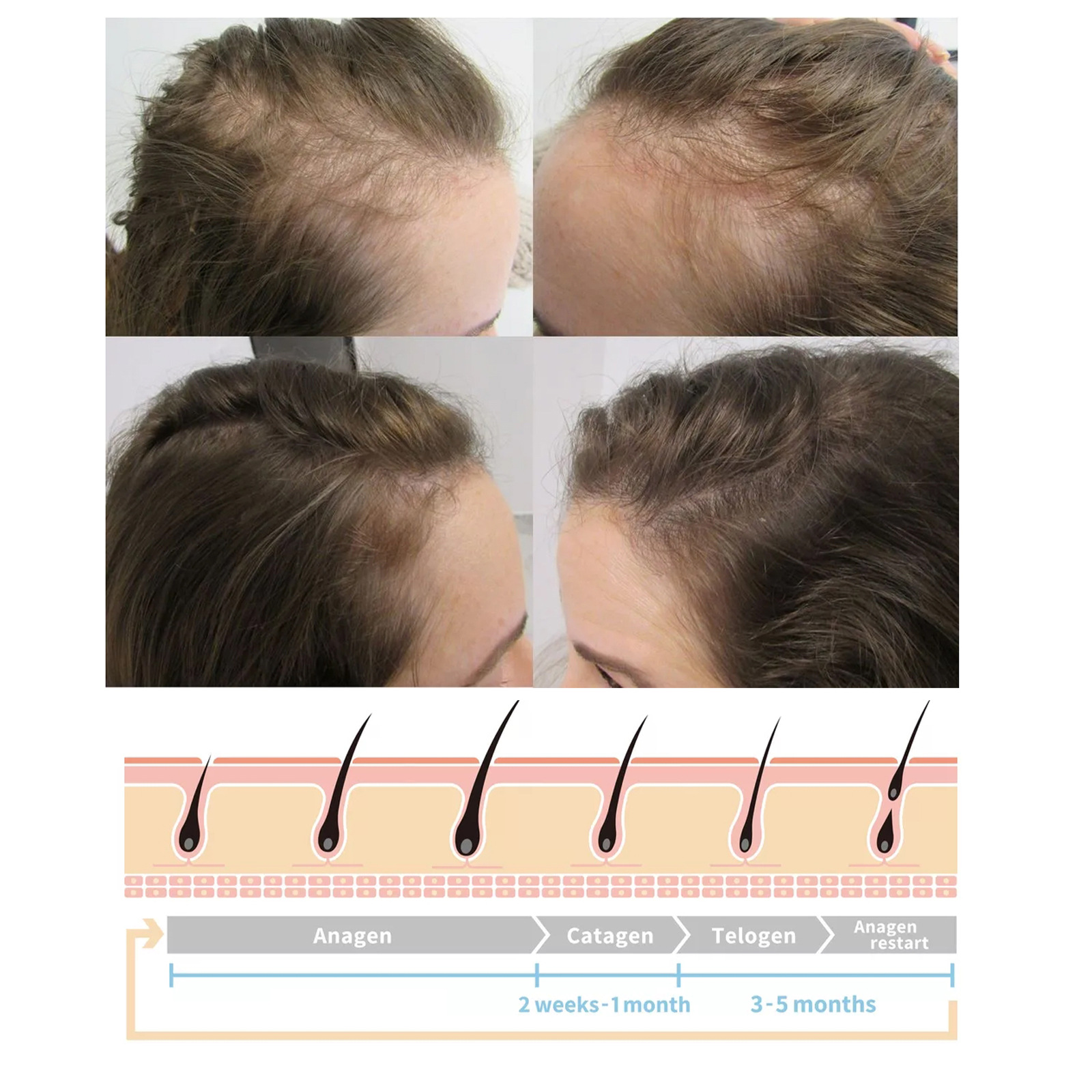 EELHOE ginger hair growth spray scalp massage moisturizing thick hair hair care nutrition spray