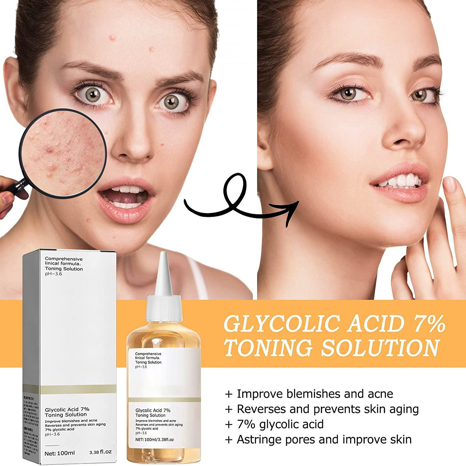 LUNOON Ethanol Glycolic Acid Skin Toner for Acne Moisturizing Skin 7% Glycolic Acid Skin Toner