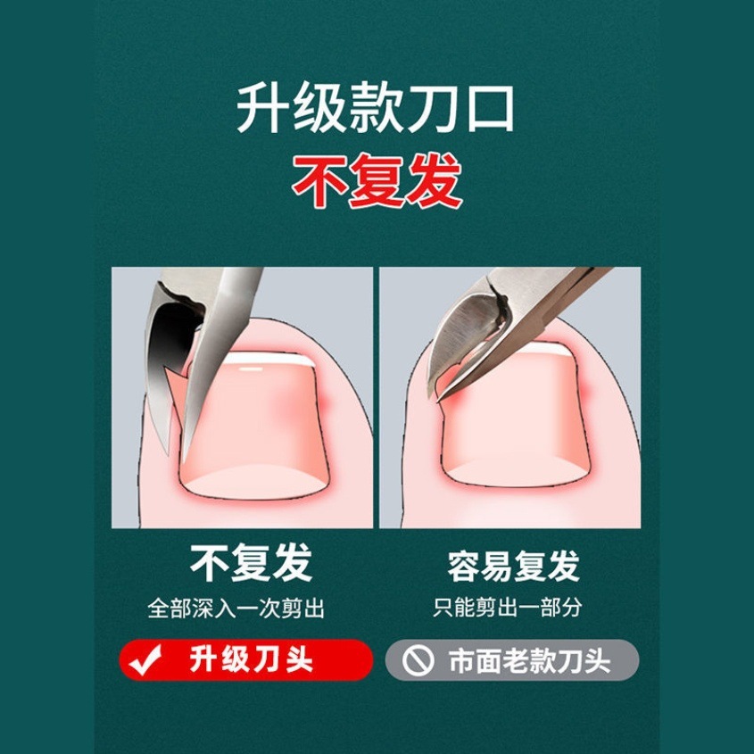 Nail scissors nail groove special oblique nail inlay eagle nose pliers pedicure nail scissors set large groove artifact inflammation