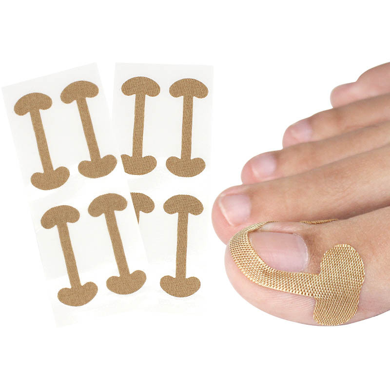 Nail groove nail inlay toe correction stickers unisex nail groove nail self-adhesive prevention nail nail nail tie into meat
