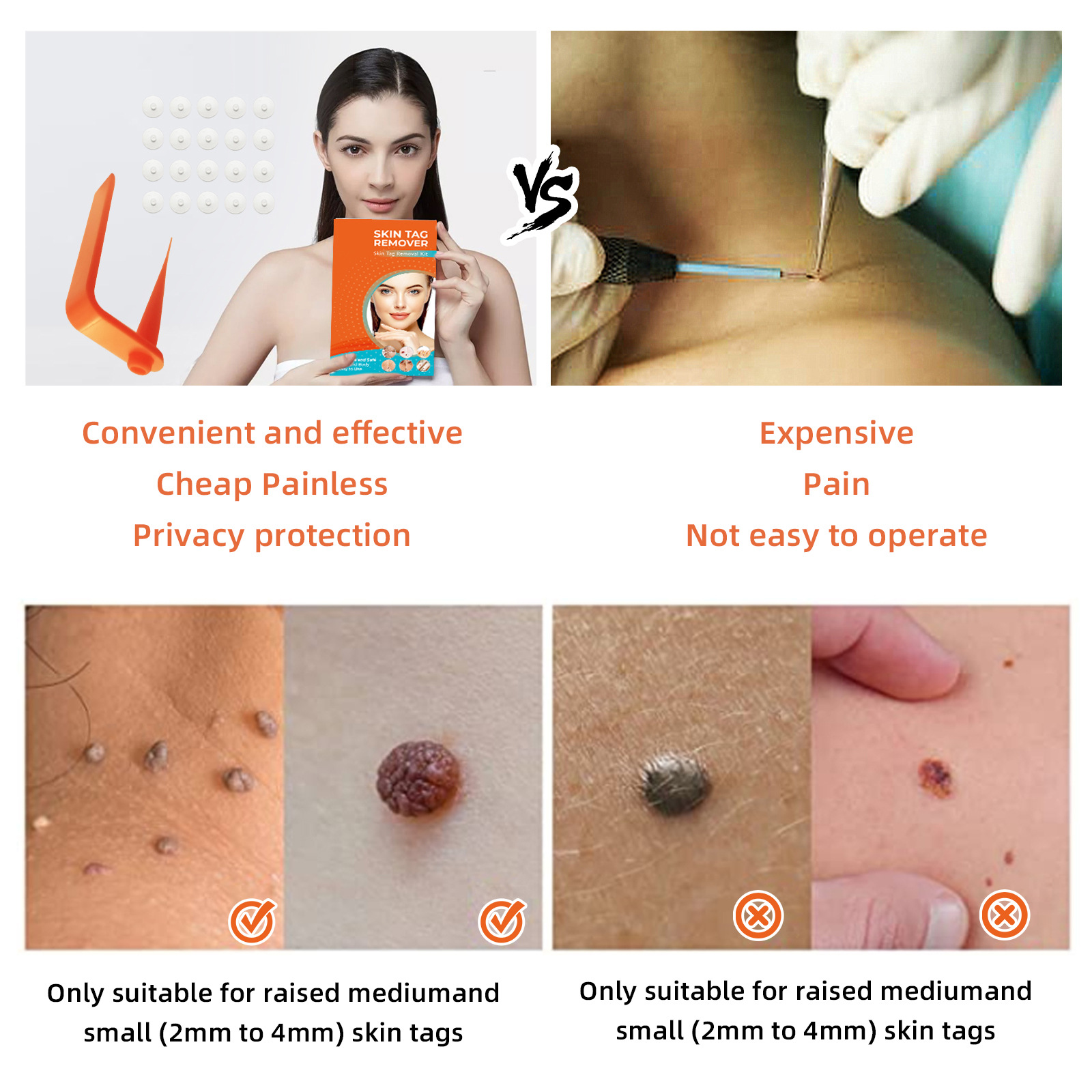 Tagband Skin Tag rubber removing moles removing corns removing wart removing Skin lifting device (including repair stickers)